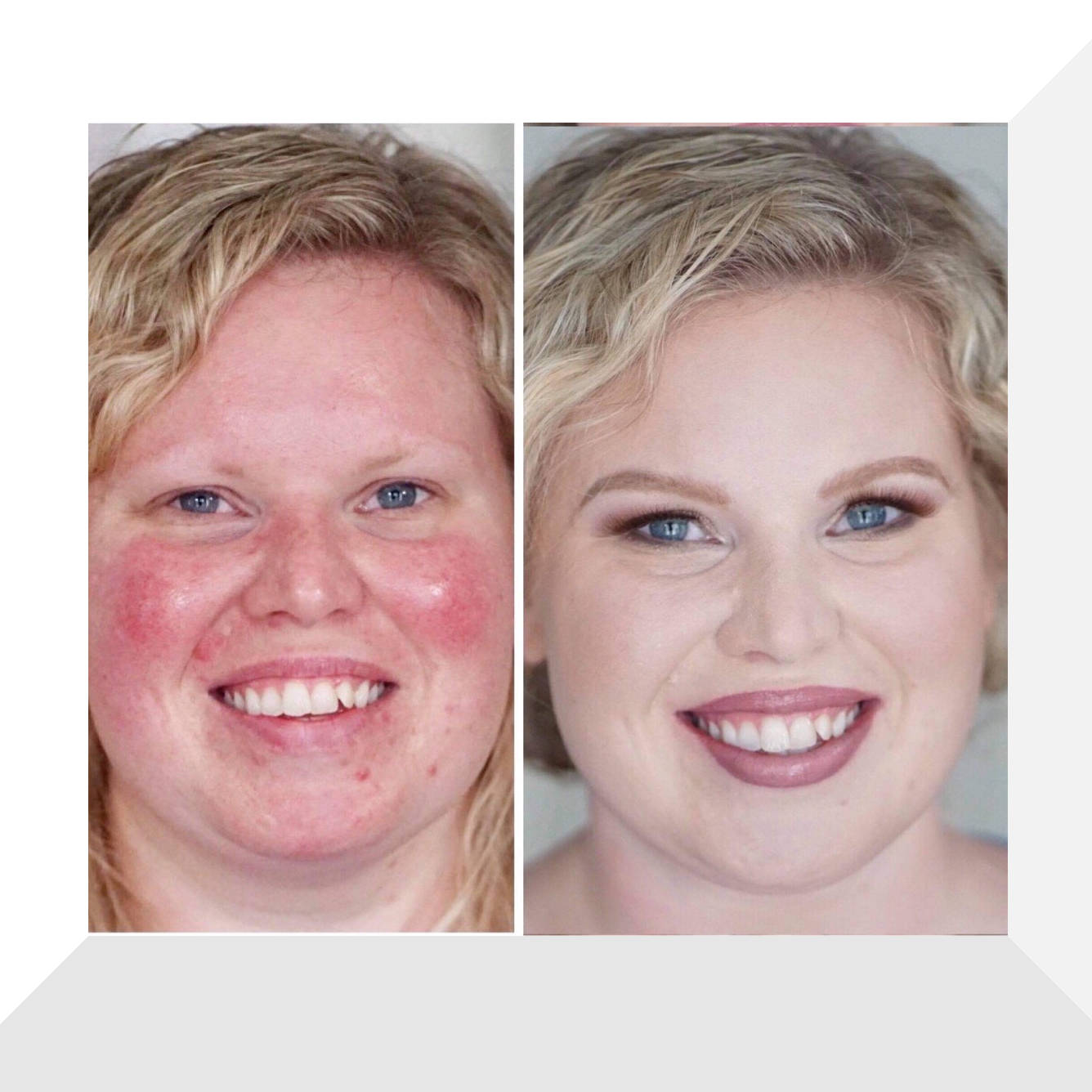 Covering Redness Wtih Makeup